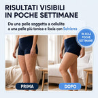 Solvierra Vacuum Anti-Cellulite Massager